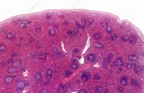 Spleen Light Micrograph Stock Image C Science Photo Library