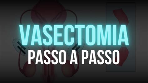 INSTRUMENTAÇÃO CIRÚRGICA UROLÓGICA VASECTOMIA PASSO A PASSO YouTube