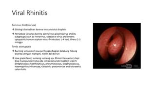 Acute And Chronic Rhinitis Pptx