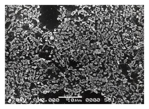 Sem Images Of H Pylori Strains Ss A And B And Tk C And