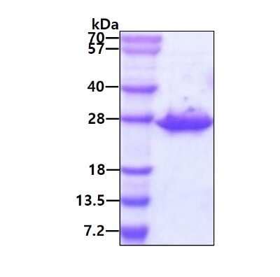 Recombinant Human Clpp Protein Nbp By Novus Part Of Bio Techne