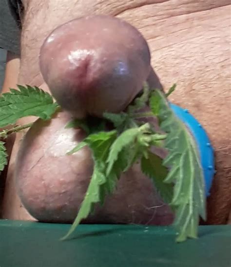 Getting The Sting Nude Pics Xhamster