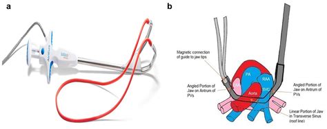 Efficacy Of A Novel Bipolar Radiofrequency Clamp An Acute Porcine