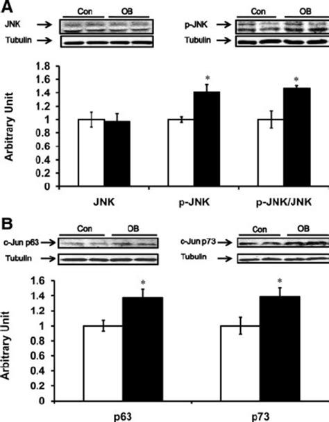 Jnk Phospho Jnk And Phospho C Jun At Ser And Ser In Fetal St