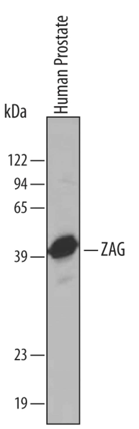 Human Zag Antibody R D Systems 100μg Unlabeledantibodies Polyclonal