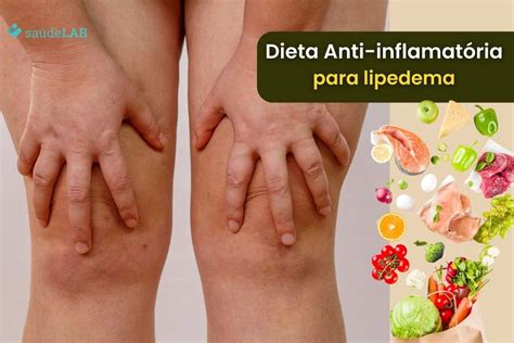 Alimentos Que Pioram O Lipedema Retoedu