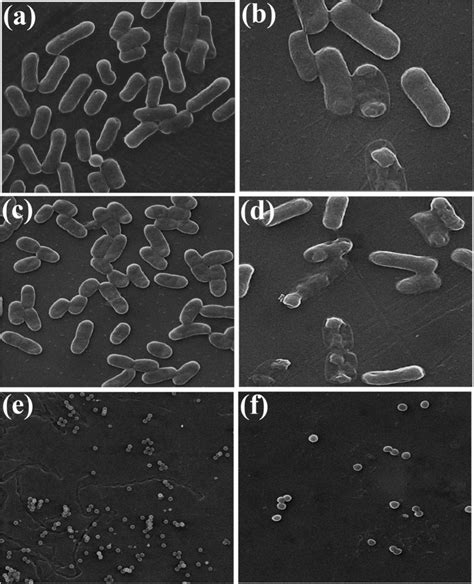 Sem Micrograph Showing Adhesion Tests Morphology Of E Coli A B P