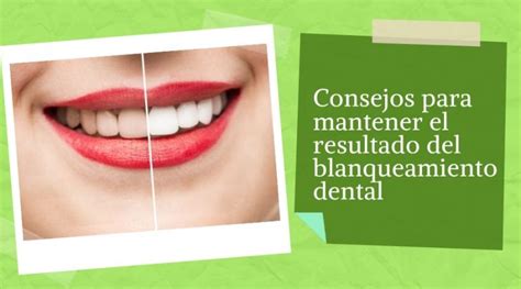 Consejos Para Mantener El Resultado Del Blanqueamiento Dental Blog De