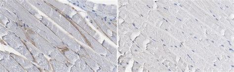 Anti α Dystroglycan Antibody Clone Iih6c4 05 593 I 100ul