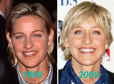 Ellen DeGeneres before and after plastic surgery (12) | Celebrity ...