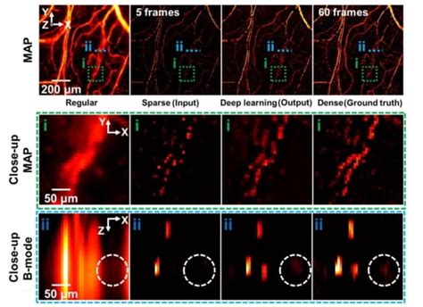 Deep Learning Accelerates Super Resolution Photoacoustic Imaging