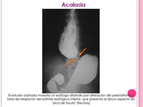 Serie Esofagogastroduodenal