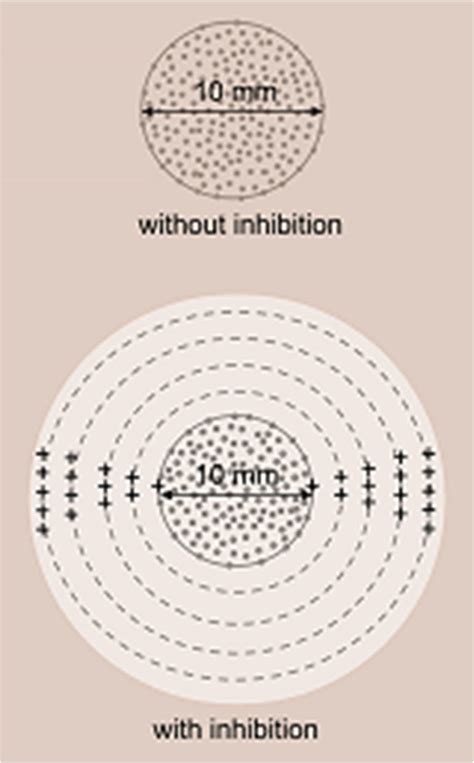 Scheme Of Quantitative Evaluation Of Inhibition Zones Download