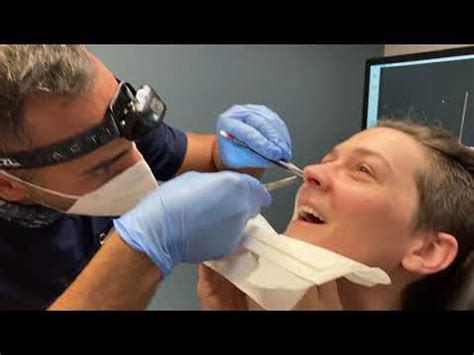 Septoplasty Nasal Splint Removal YouTube