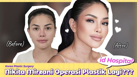 Nikita Mirzani Operasi Plastik Lagi Di Korea Youtube