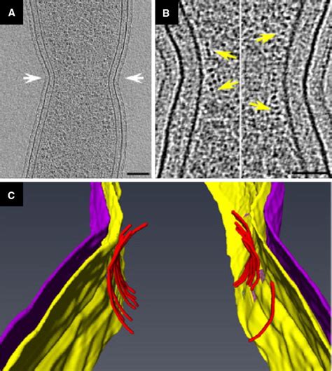 Cryo Transmission Electron Micrographs Of FtsZ In Caulobacter