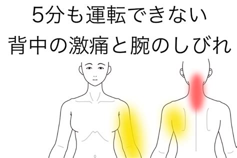 しらお鍼灸院における実際の首の痛みの症例です。参考にご覧ください