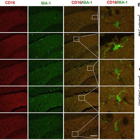 Blockade Of Sirt1 Abolished The Inhibition Of Microglia Activation