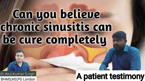 Homeopathy Magic Of Homeopathic Treatment Sinusitis Nasal Polyp Nasal Obstruction