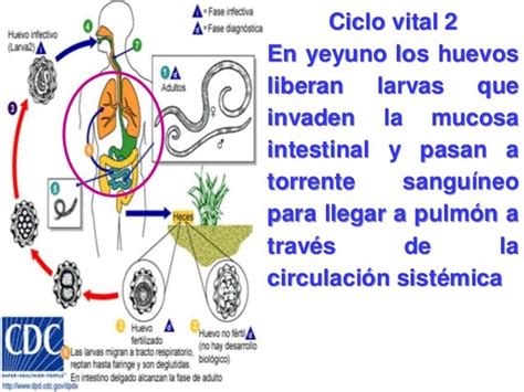 Ascariasis