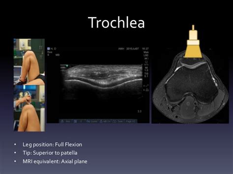 Ultrasound - Knee