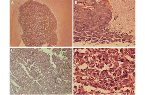 Histopathology Of Xenograft Tumor And Human Gbm A Xenograft Tumor