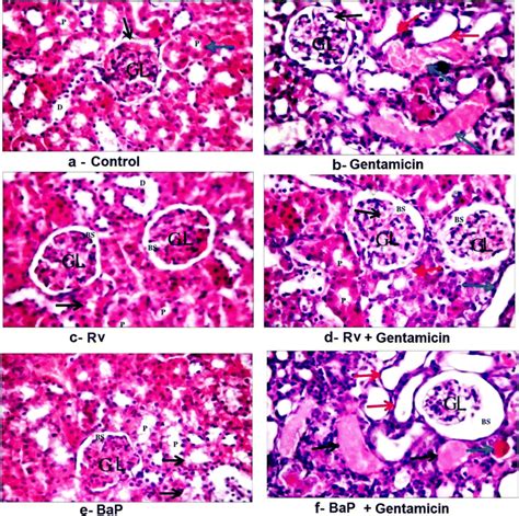 Representative Photomicrographs Showing The Histopathology Of Rat