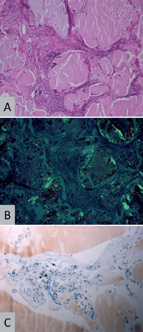 Histopathology Representative Histopathology Patient 2 Showing