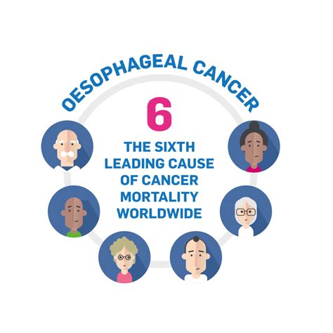 About Oesophageal Cancer – Oesophageal Cancer Fund