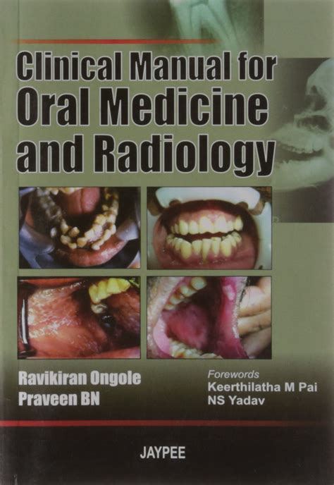 Buy Textbook Of Oral Medicine And Radiology Aibh In