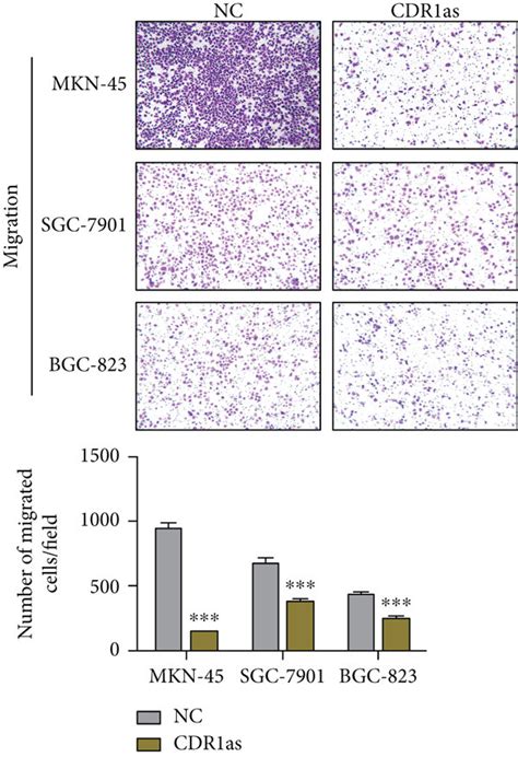 Cdr As Overexpression Inhibits Metastasis Of Gc Cells In Vitro And In