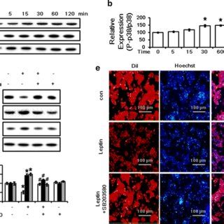 Inhibition Of Pcsk Expression Returned Ldlr Expression And Ldl Uptake