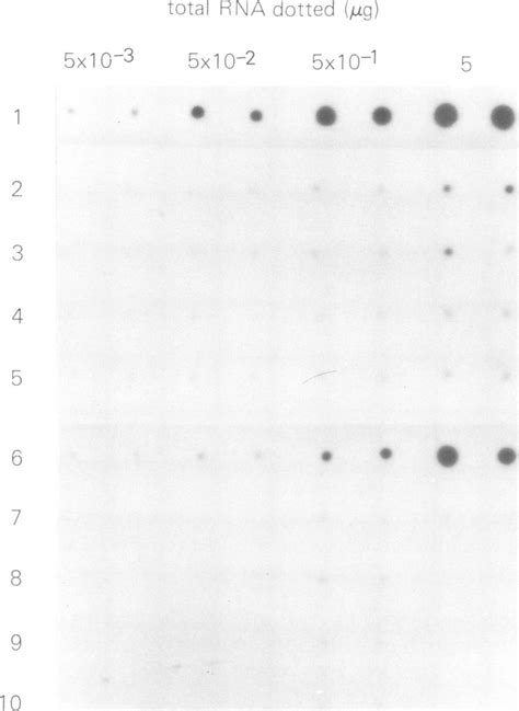 An Autoradiogram Of 32p Labelled Afp Cdna Probe Hybridized To Total Rna