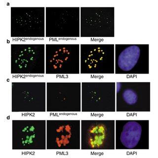 Colocalization Of Hipk With P Cbp And Pml In Pml Nbs A H Cells