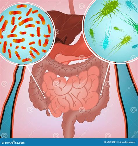 Intestinal Infection Image Stock Vector Illustration Of Banner 67420829