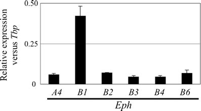 Expression Of Candidate Ephs Interacting With Ephrin B2 In The Anterior