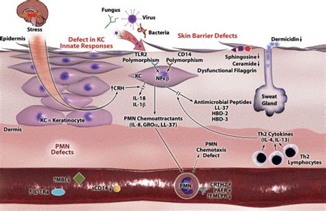 Innate Immune Defects In Atopic Dermatitis Journal Of Allergy And