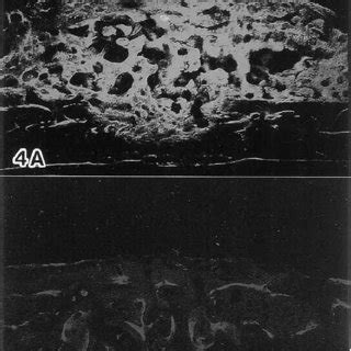 Histological Appearance Of Calvaria After Implantation Of Rhbmp With