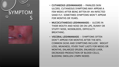 Trypanosoma And Leishmania Ppt