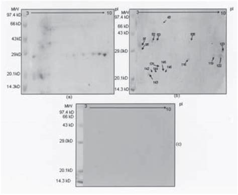 2d Gel Electrophoresis A And Corresponding Specific Ige Immunoblots