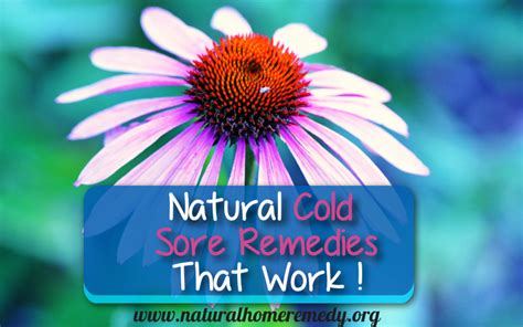 Natural Cold Sore Remedies That Work | Homemade Cold Sore Remedies