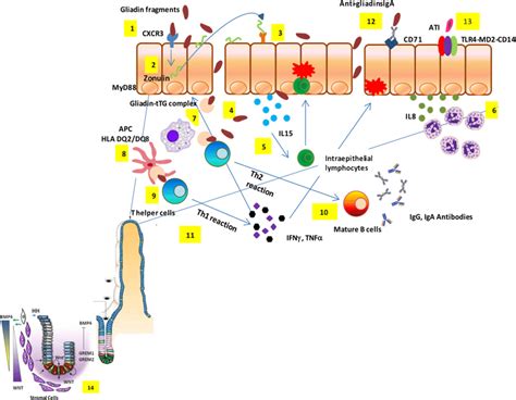 Celiac Disease Pathogenesis Partially Digested Gliadin Fragments