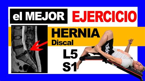 El Mejor Ejercicio Para La Hernia Discal L5 S1 Youtube