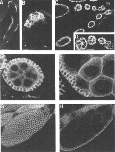 Figure 4 From The Drosophila Lethal 2 Giant Larvae Tumor Suppressor