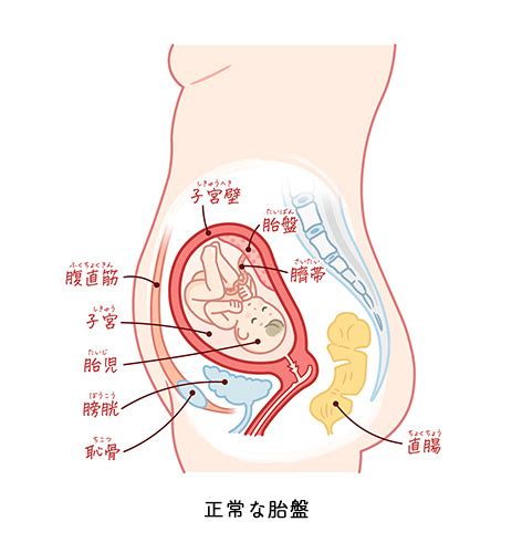 前置胎盤とは？原因や治し方、日常生活の過ごし方、出産方法について 札幌市清田区の産婦人科「札幌みらいクリニック」