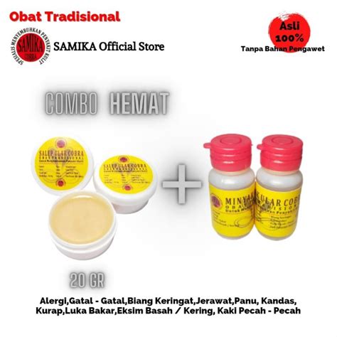 Jual Salep Ular Cobra Kecil Minyak Ular Cobra Obat Gatal Eksim Alergi