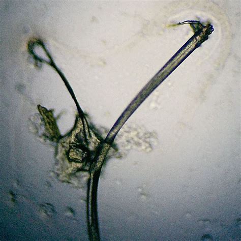 Face Worm Parasite 8mm Total Photo Of End Section Detail With Appendage On Curezone Image