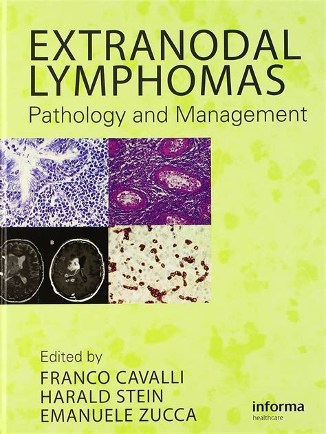 Amazon Extranodal Lymphomas Pathology And Management Cavalli