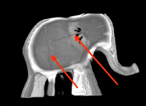 X Ray Tomography