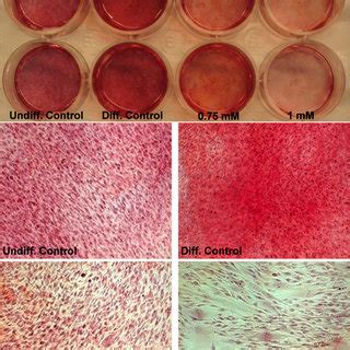 Cellular Morphology Of Hmsc Tert After Go Treatment The Upper Panel